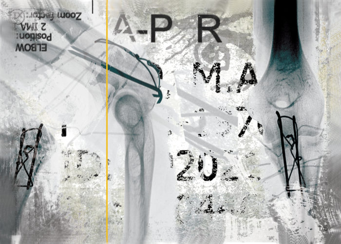 Temporary Out Of Order