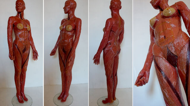 Anatomie Corpus Suave- Duo Ongezoet- 2014>2016
